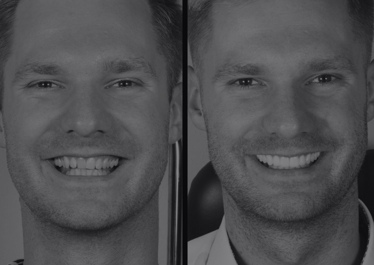 Реабілітація 1